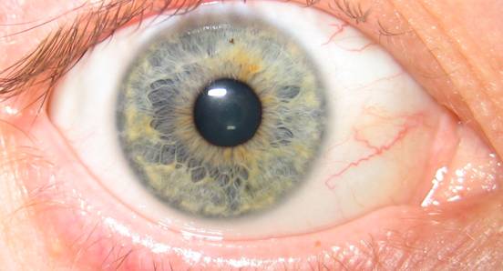 Iridology blue eye