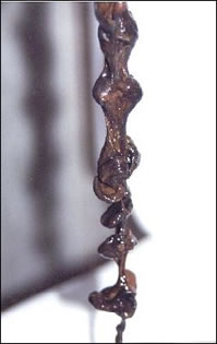 mucoid plaque